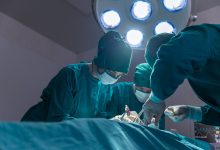 Cirurgia sem dreno: técnica, segurança e recuperação mais leve