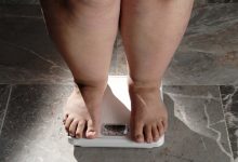 Você sabia que o excesso de peso acelera a artrose no joelho