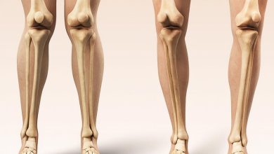 Seus joelhos estão alinhados Veja o que o formato das suas pernas pode revelar