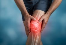 Lesão de menisco sempre precisa de cirurgia Veja a verdade