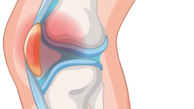 Dor na frente do joelho Pode ser condropatia patelar